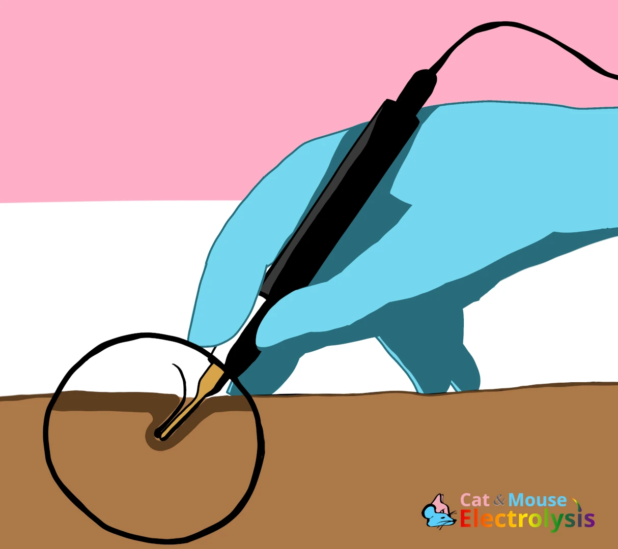 Visual aid for the process of electrolysis.